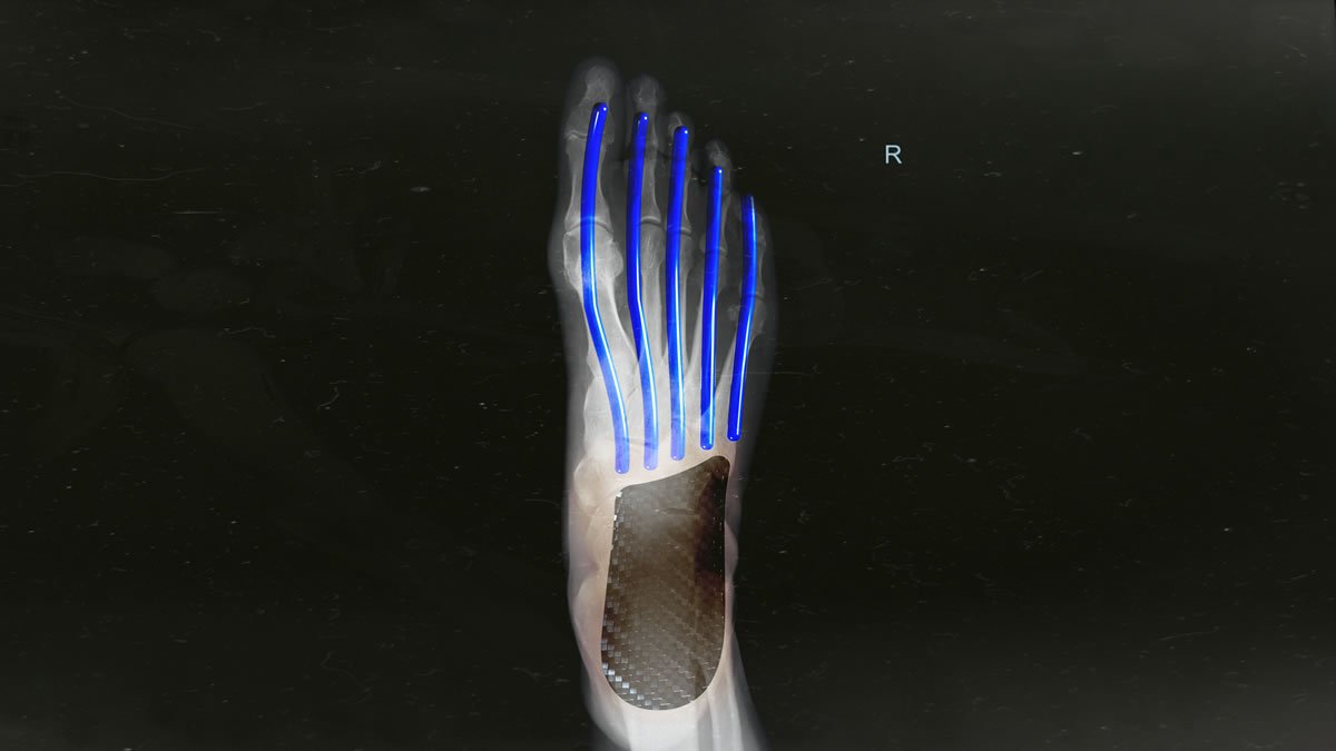 Lightstrike: Adidas